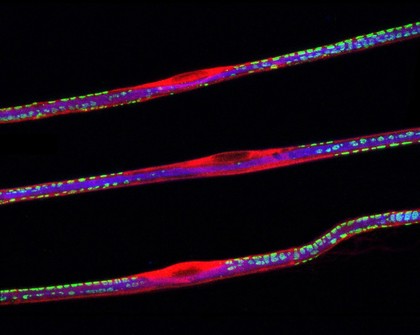 Sciatic nerve fibres