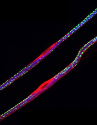 Sciatic nerve fibres