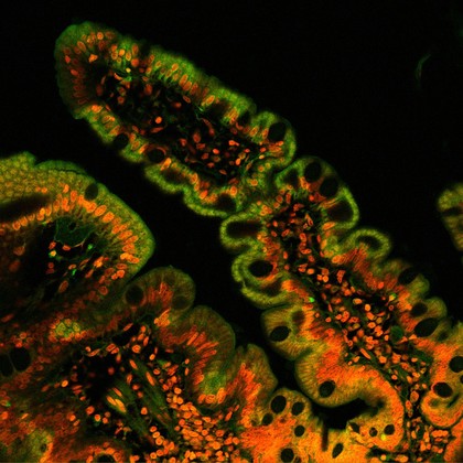Villus from the human duodenum