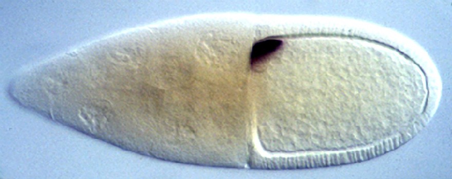 Polarity in Drosophila oocyte - gurken mRNA