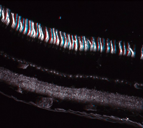 Cone rich area of the retina - 3D image