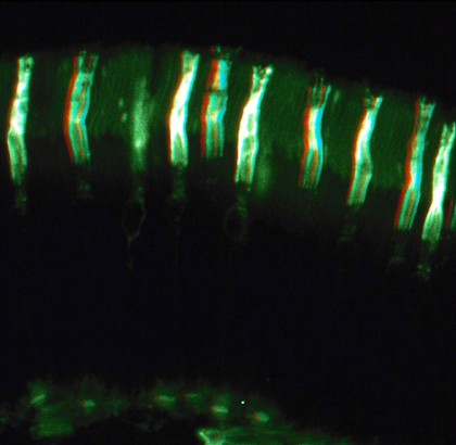 Cones in the retina - 3D image