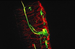 view Unusual nerve cell in the retina