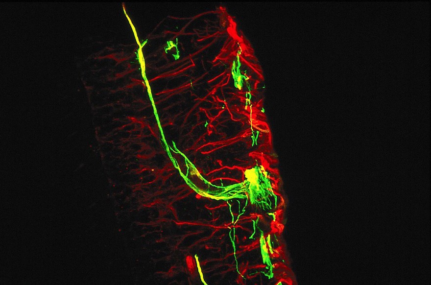 Unusual nerve cell in the retina