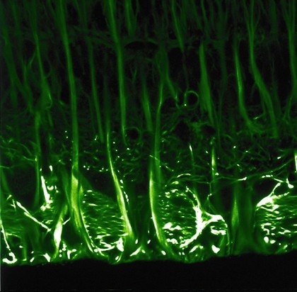 Bundles of ganglion cells in the retina