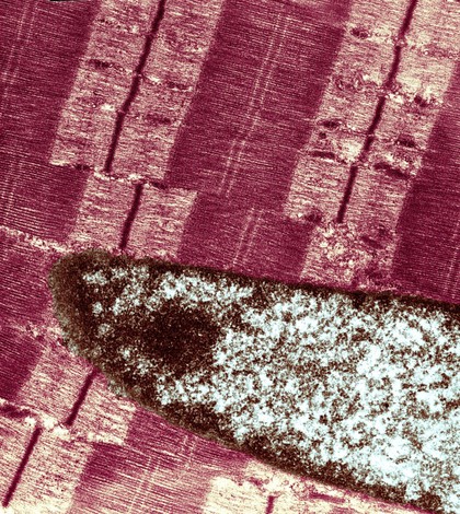 Sarcomeres in myofibrils of relaxed skeletal muscle
