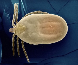 view Tick - Ixodes canisuga - colour-enhanced SEM