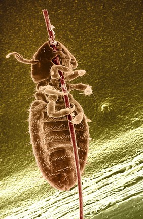 Ox louse clinging to a hair - coloured SEM