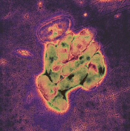 Bacteria from the intestine