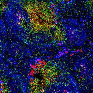 Normal spleen showing B cells and T cells