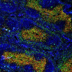 view Normal spleen showing B cells and T cells