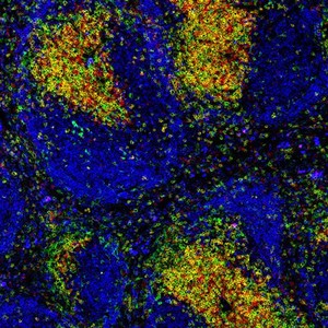 view Normal spleen showing B cells and T cells