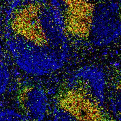 Normal spleen showing B cells and T cells
