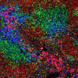 view Normal spleen showing B cells and T cells