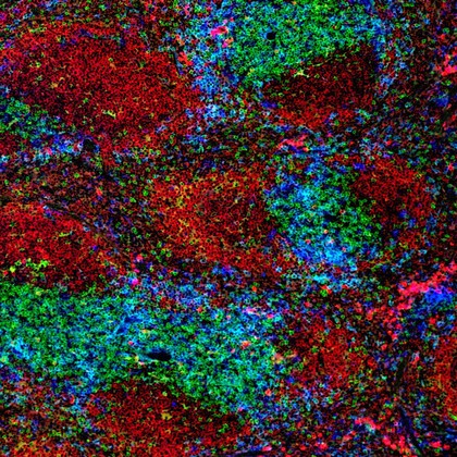 Normal spleen showing B cells and T cells