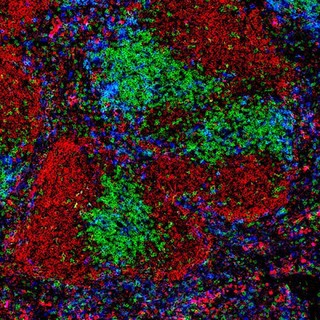 Normal spleen showing B cells and T cells