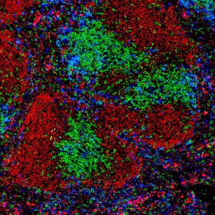 Normal spleen showing B cells and T cells