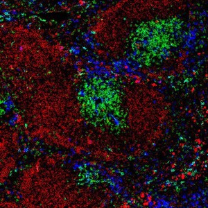 view Normal spleen showing B cells and T cells