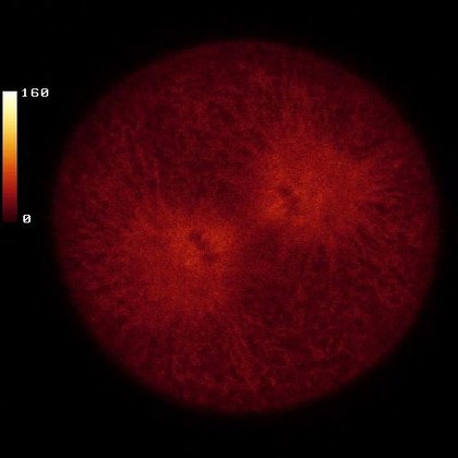 Sea urchin mitosis movie, microtubules