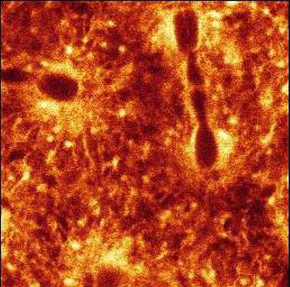 Drosophila development, endoplasmic reticulum