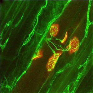 view Poly-innervated neuromuscular junctions