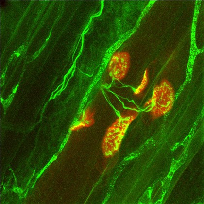 Poly-innervated neuromuscular junctions