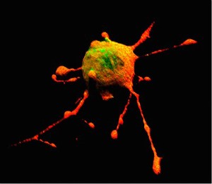 view Pheochromocytoma cell