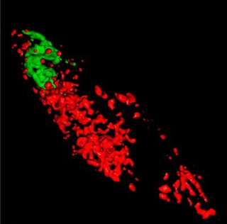 Tumour cell showing cellular components