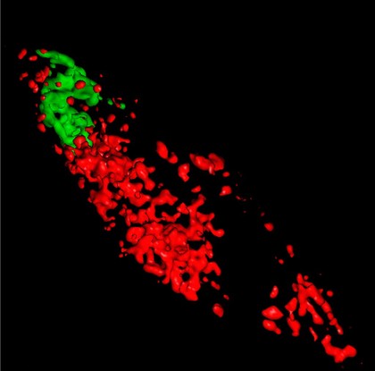 Tumour cell showing cellular components