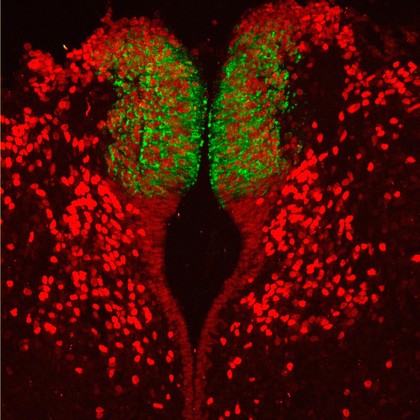 Subcommissural organ in the developing brain