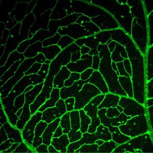 view Branching blood vessels in the retina