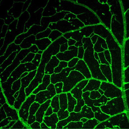 Branching blood vessels in the retina