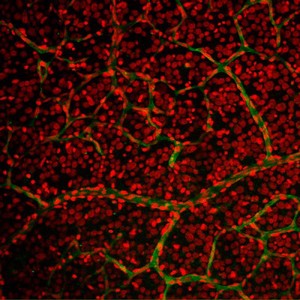 view Retinal capillary bed with nuclei