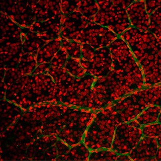 Retinal capillary bed with nuclei