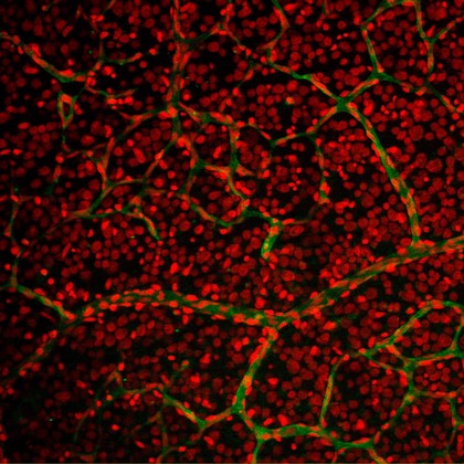Retinal capillary bed with nuclei