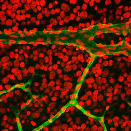 Retinal blood vessels with nuclei
