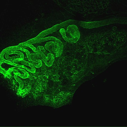 Embryonic kidney in culture
