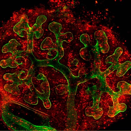 Embryonic kidney with proliferating cells
