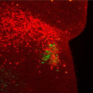 view Catecholaminergic neurons in the brain