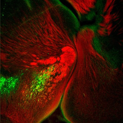 Catecholaminergic neurons in the brain