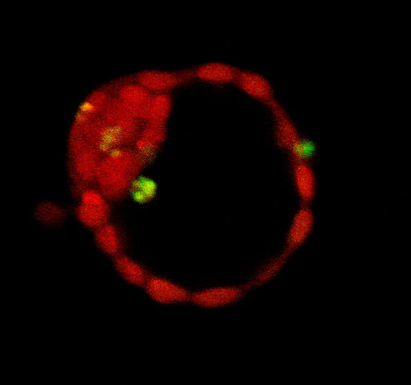 Apoptotic cells in a mouse blastocyst