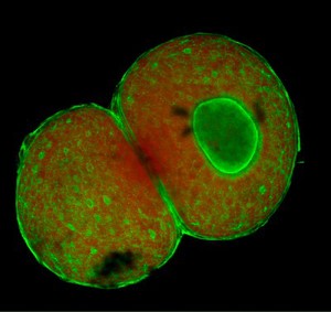 view Isolated ovarian follicles from the mouse