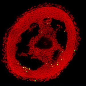 view Apoptosis in an isolated ovarian follicle