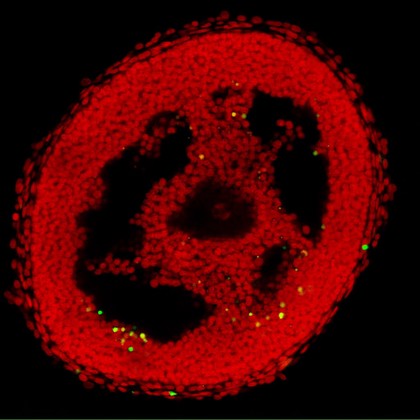 Apoptosis in an isolated ovarian follicle