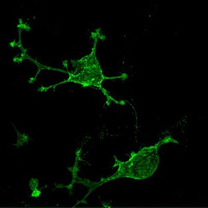 view Green Fluorescent Protein transfected cells