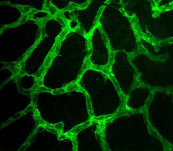 Retinal capillary bed
