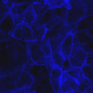 view Cells showing serotonin transporter protein