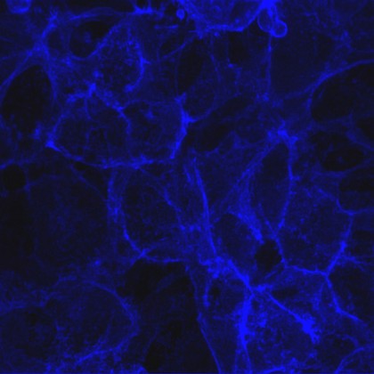 Cells showing serotonin transporter protein