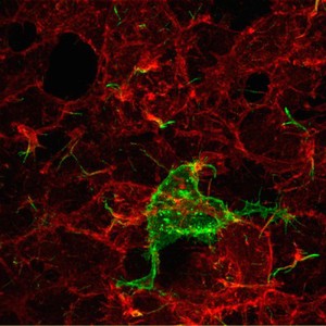 view GFP-labelled cell and 5HT receptors