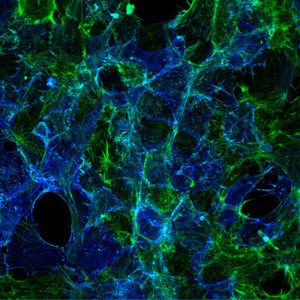 view Cells showing serotonin transporter protein